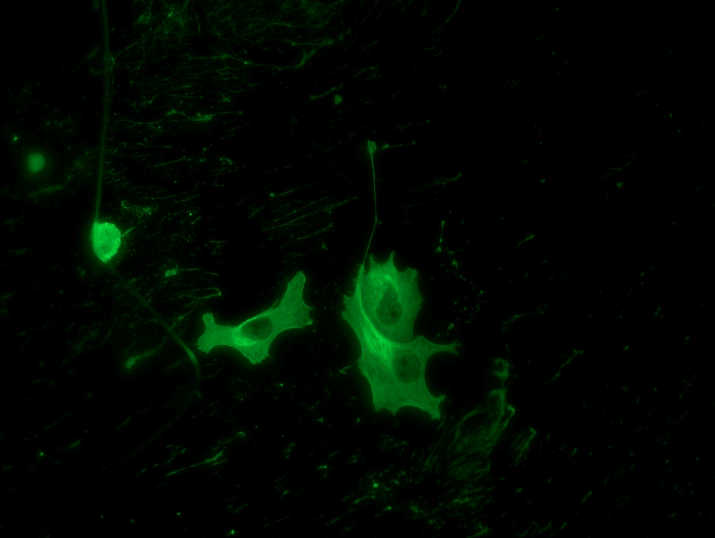 6a9a25345592a.png Fluorescent-light-intensity-memory-function-2-1024x770.png